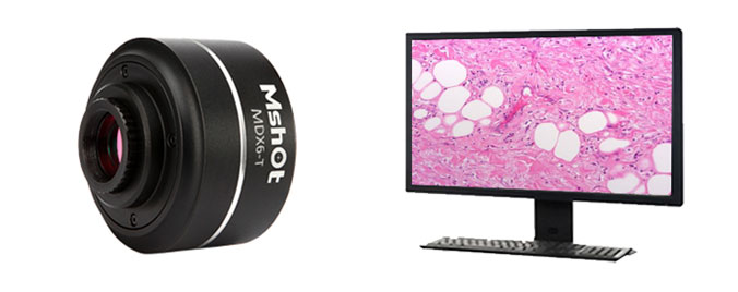 顯微鏡相機MV-6T 1600萬超高分辨率顯微數(shù)碼相機 64M內(nèi)存 顯微鏡相機MV-6T 1600萬超高分辨率顯微數(shù)碼相機 64M內(nèi)存