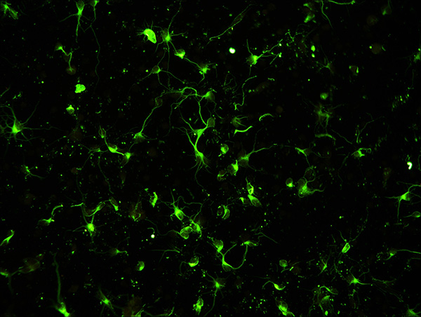 MV20-N 顯微鏡攝像頭 攝像頭 MV20-N 顯微鏡攝像頭 攝像頭