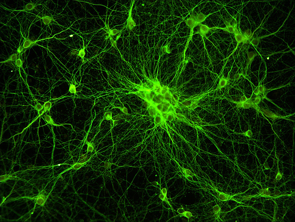 MV20-N 顯微鏡攝像頭 攝像頭 MV20-N 顯微鏡攝像頭 攝像頭