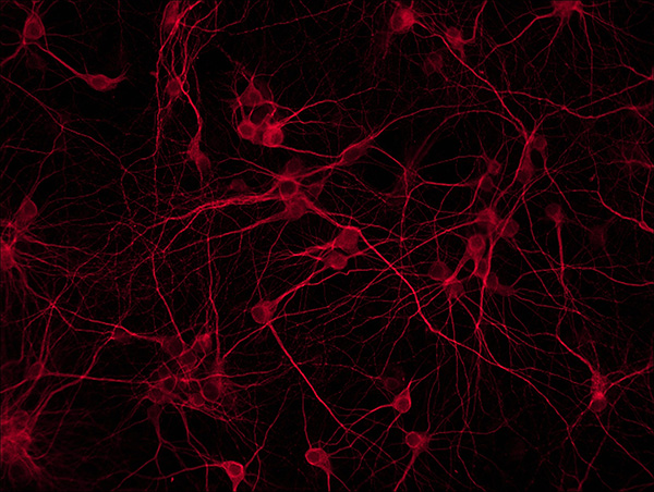MV20-N 顯微鏡攝像頭 攝像頭 MV20-N 顯微鏡攝像頭 攝像頭